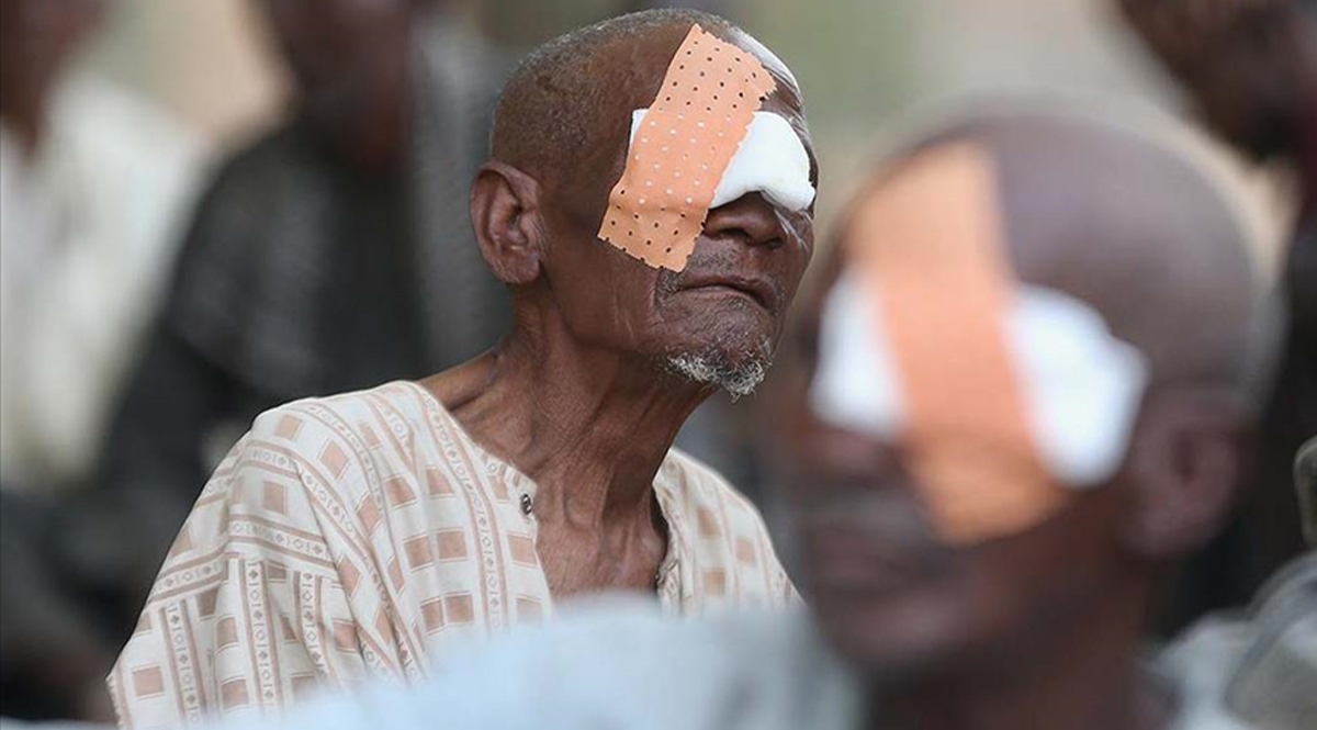 Katarakt Göz Ameliyatı Katılım